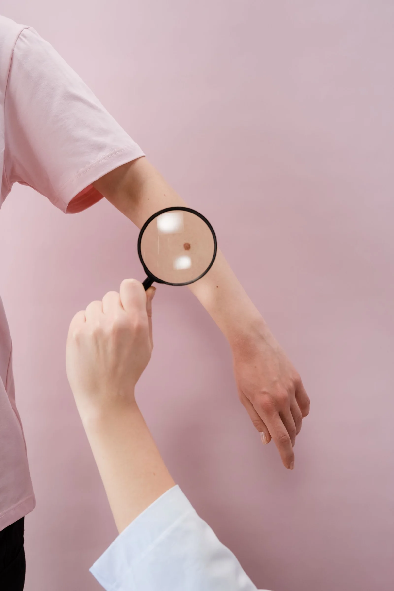 Exploración detallada de una lesión pigmentada con una lupa clínica.